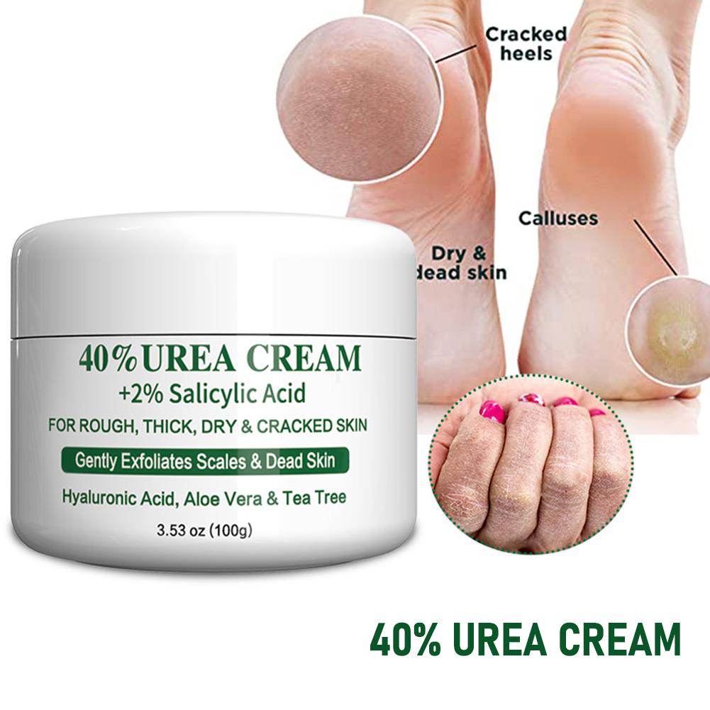 Urea Foot Cream - 42% Urea Cream Autumn And Winter