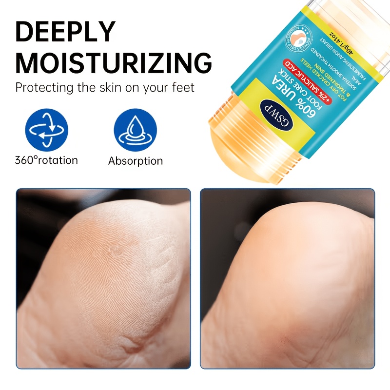 قلم العناية بالقدمين GSWP بنسب - مراجعة Urea Foot Cream وسعره