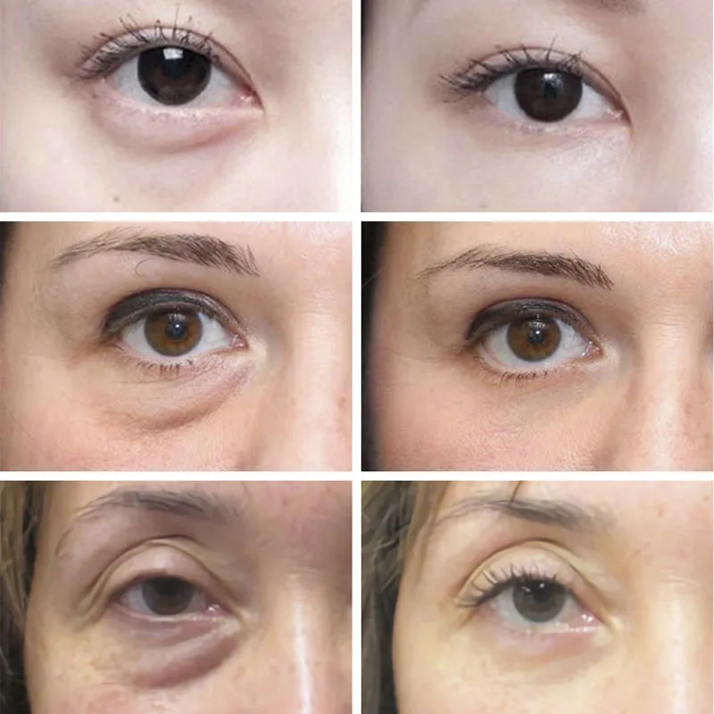 المضادة للتجاعيد المضادة للهال - مراجعة Skincare D'Alba وسعره