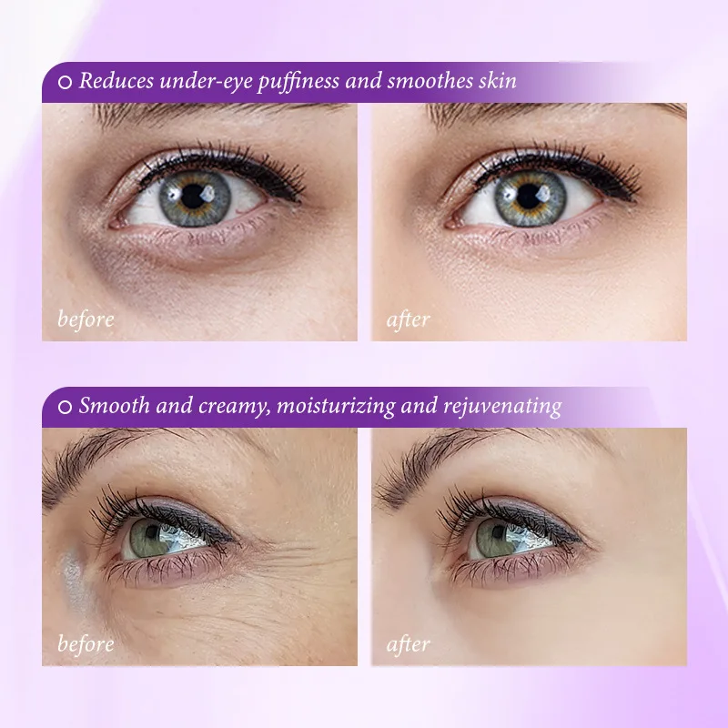 كريم فوري لإزالة انتفاخات العي - مراجعة Skincare D'Alba وسعره